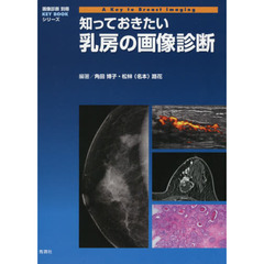 知っておきたい乳房の画像診断