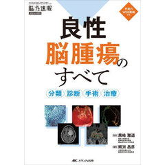 良性脳腫瘍のすべて　分類・診断・手術・治療