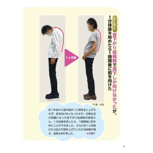 丸まった背中曲がった腰・うつむいた首何歳からでも自分で