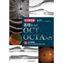 京大眼科版基礎からのＯＣＴ・ＯＣＴＡ入門