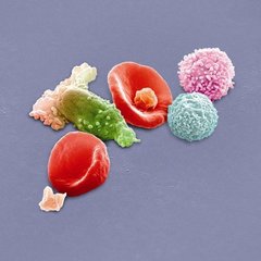 ニュー・ブラッド－ライヴ・イン・ロンドン・デラックス・エディション（Ｂｌｕ－ｒａｙ　Ｄｉｓｃ）