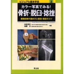 カラー写真でみる！骨折・脱臼・捻挫　画像診断の進め方と整復・固定のコツ