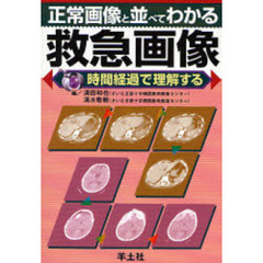 正常画像と並べてわかる救急画像　時間経過で理解する
