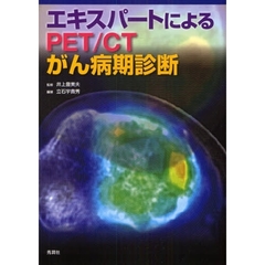 エキスパートによるＰＥＴ／ＣＴがん病期診断