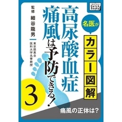 名医がカラー図解！ 高尿酸血症・痛風は予防できる！ (3) 痛風の正体は？