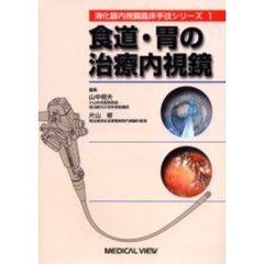 食道・胃の治療内視鏡
