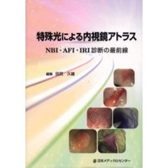 特殊光による内視鏡アトラス　ＮＢＩ・ＡＦＩ・ＩＲＩ診断の最前線