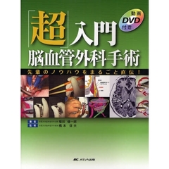 「超」入門脳血管外科手術　先輩のノウハウをまるごと直伝！