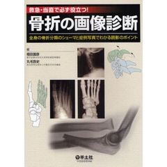 骨折の画像診断　救急・当直で必ず役立つ！　全身の骨折分類のシェーマと症例写真でわかる読影のポイント