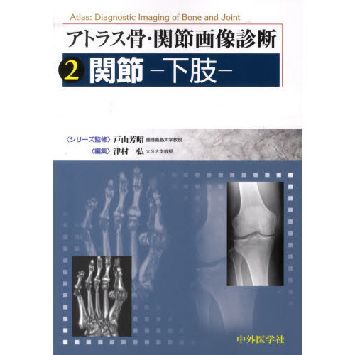 アトラス骨・関節画像診断 2 / 戸山芳昭 - 紀伊國屋書店ウェブ