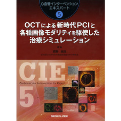 ＯＣＴによる新時代ＰＣＩと各種画像モダリティを駆使した治療シミュレーション