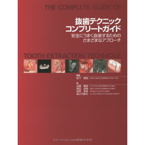 抜歯テクニックコンプリートガイド 安全にうまく抜歯するための