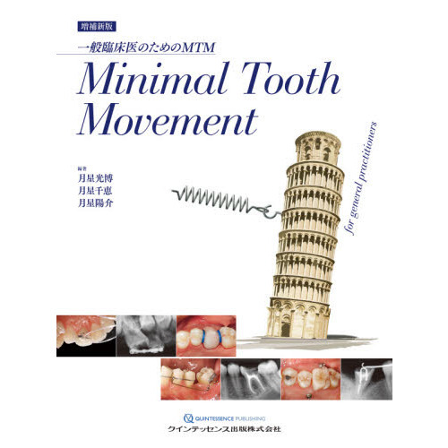 一般臨床医のためのMTM Minimal Tooth Movement Minimal Tooth Movement 一般臨床医のための