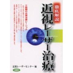 徹底解説近視レーザー治療
