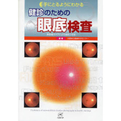 手にとるようにわかる健診のための眼底検査　無散瞳カメラによる撮影と判定