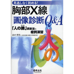 胸部Ｘ線画像診断Ｑ＆Ａ　見逃しなく読める！　「人の肺」読影法と症例演習