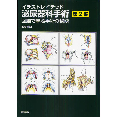 イラストレイテッド泌尿器科手術 第2集 図脳で学ぶ手術の秘訣 - 健康・医学