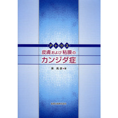 アトラス皮膚および粘膜のカンジダ症