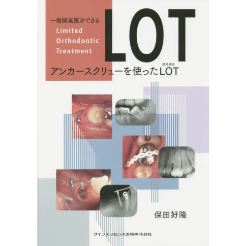 ̳Ȱ夬Ǥ륢󥫡塼ȤäLOTβ