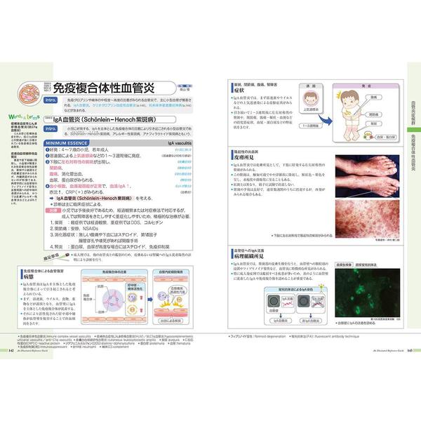 病気がみえる vol.6 免疫・膠原病・感染症　第２版　免疫・膠原病・感染症