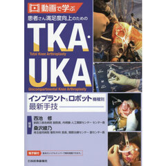 動画で学ぶ患者さん満足度向上のためのＴＫＡ・ＵＫＡインプラント＆ロボット機種別最新手技