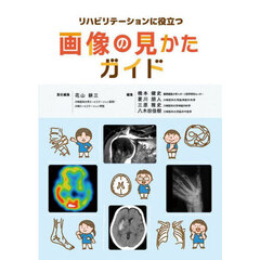 リハビリテーションに役立つ画像の見かたガイド