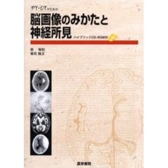 ＰＴ・ＯＴのための脳画像のみかたと神経所見