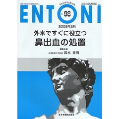 ＥＮＴＯＮＩ　Ｍｏｎｔｈｌｙ　Ｂｏｏｋ　Ｎｏ．９８（２００９年２月）　外来ですぐに役立つ鼻出血の処置