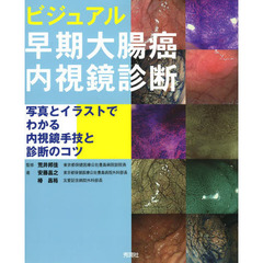 ビジュアル早期大腸癌内視鏡診断　写真とイラストでわかる内視鏡手技と診断のコツ