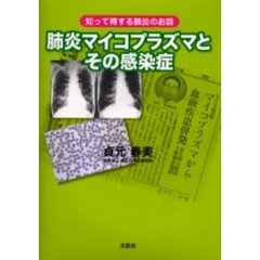 肺炎マイコプラズマとその感染症　知って得する肺炎のお話
