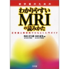 初学者のためのわかりやすいＭＲＩの読みかた　正常像と典型例でひもとく入門ガイド