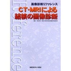 ＣＴ・ＭＲＩによる結核の画像診断