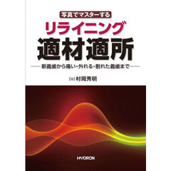 写真でマスターするリライニング適材適所　新義歯から痛い・外れる・割れた義歯まで