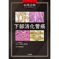 下部消化管癌