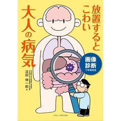 放置するとこわい大人の病気　画像診断で早期発見
