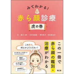 みてわかる！赤ら顔診療虎の巻