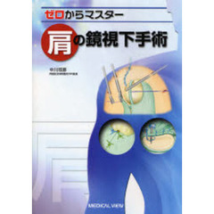 ゼロからマスター肩の鏡視下手術