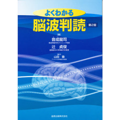 よくわかる　脳波判読　第２版