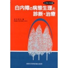 白内障の病態生理と診断・治療