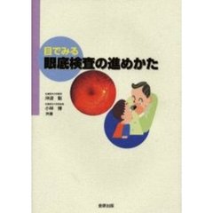 目でみる眼底検査の進めかた