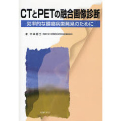 ＣＴとＰＥＴの融合画像診断　効率的な腫瘍病巣発見のために