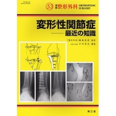変形性関節症　最近の知識