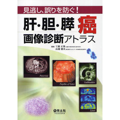 見逃し、誤りを防ぐ！肝・胆・膵癌画像診断アトラス