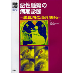 悪性腫瘍の病期診断　治療法と予後の分岐点を見極める