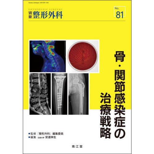 セブンネットショッピングで買える「骨・関節感染症の治療戦略」の画像です。価格は7,150円になります。