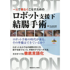 一人で難なくこなすためのロボット支援下結腸手術