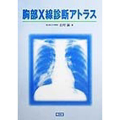 胸部Ｘ線診断アトラス