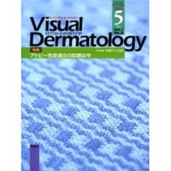Ｖｉｓｕａｌ　Ｄｅｒｍａｔｏｌｏｇｙ　Ｖｏｌ．１Ｎｏ．２（２００２－５）　〈特集〉アトピー性皮膚炎の診断は今