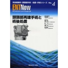 頭頚部再建手術と術後処置