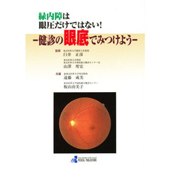 緑内障は眼圧だけではない！　健診の眼底で